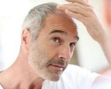 民间治疗白发的偏方 治疗白发的偏方