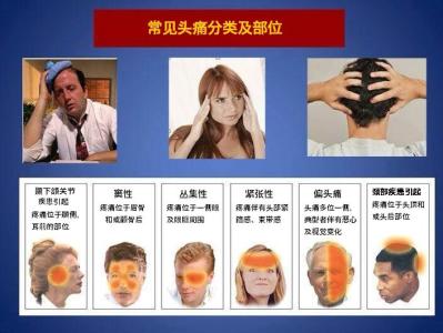 偏头痛最常见的类型是 常见头痛类型有哪几种