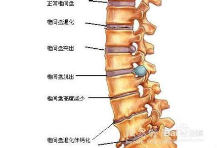 保护腰椎的椅子 如何保护腰_保护腰椎有哪些方法