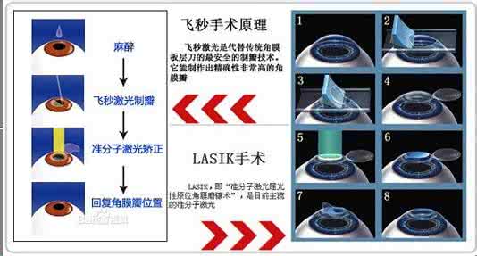 宝宝近视眼食谱 治疗近视的食谱有哪些