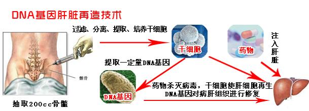 肝硬化最佳治疗方法 肝硬化怎么形成的 肝硬化的治疗方法