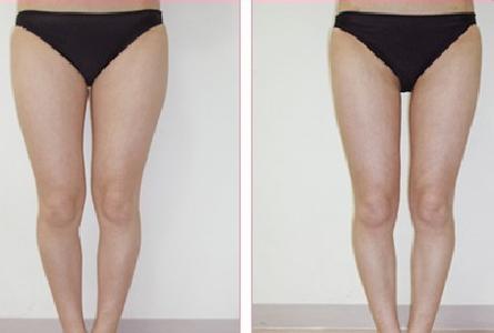 女生瘦腿最有效方法 怎么瘦腿最快