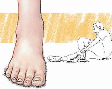 扭伤急救措施 脚扭伤如何急救 脚扭伤的急救措施都有哪些