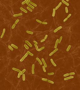 大肠杆菌的危害 大肠杆菌的危害 大肠杆菌的防治方法