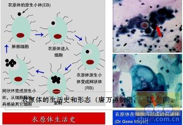 衣原体感染检查 衣原体感染的检查方法 衣原体感染怎么检测