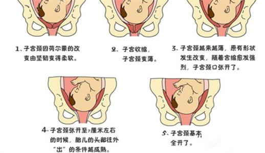 分娩恐惧 分娩恐惧_分娩恐惧如何预防