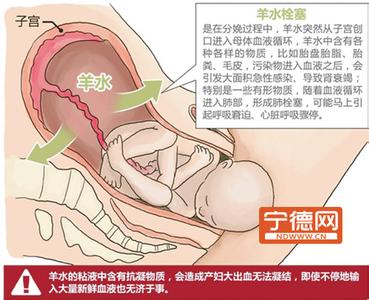 孕期注意：五类产妇须留意羊水栓塞