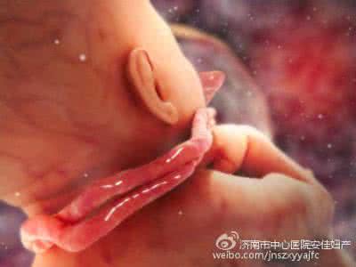 脐带绕颈窒息 脐带绕颈会导致宝宝窒息吗