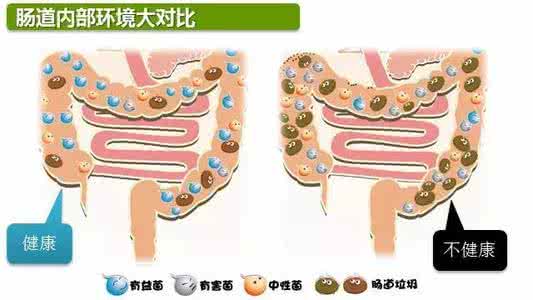 肠道功能紊乱怎么调理 肠道功能紊乱吃什么药