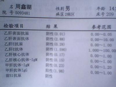 肝功能异常的表现 肝功能异常有哪些表现 肝功能异常的表现