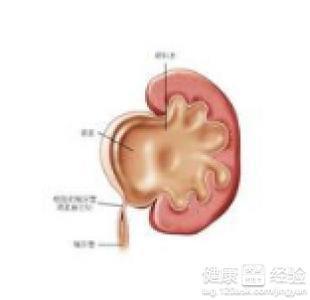肾积水食疗方法 肾积水吃什么比较好