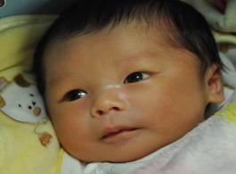 早产儿护理注意事项 早产儿黄疸高注意事项