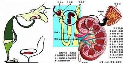 血精图片 血精是怎么形成的