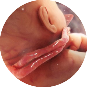 如何避免胎儿脐带绕颈 如何避免胎宝宝脐带绕颈