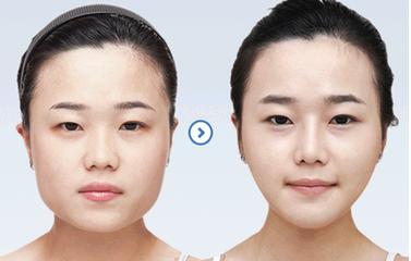 不同脸型的化妆技巧 不同脸型瘦脸技巧