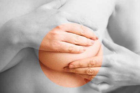乳房湿疹怎么治疗 秋季乳房湿疹治疗与预防