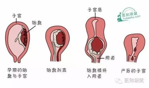产后恶露和月经的区别 如何区别出产后是恶露还是月经