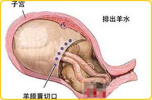 剖腹产的过程一般多久 剖腹产要多长时间