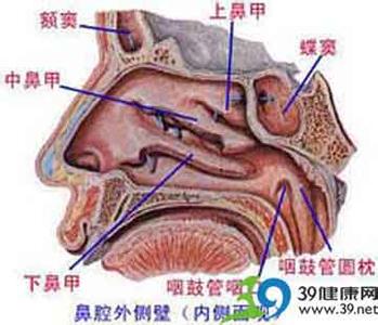 鼻咽癌形成时间 鼻咽癌形成的原因(2)