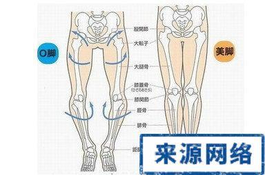 罗圈腿是怎么形成的 罗圈腿是怎么形成的 罗圈腿的形成原因