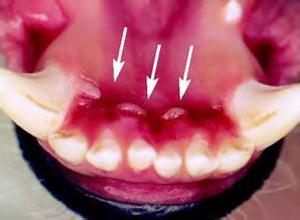 孕妇牙龈出血怎么缓解 缓解牙龈出血的健康食物