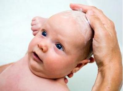 宝宝头上乳痂 新宝宝头上的乳痂要怎么去除？