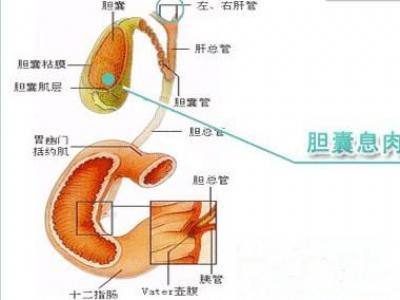 胆囊息肉的形成原因 胆囊息肉是怎样形成的 胆囊息肉有哪几种