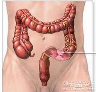 肠梗阻是怎么造成的 肠梗阻怎么形成的