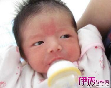 新生儿肺炎判断标准 判断新生儿正常的标准 正常新生儿的特征