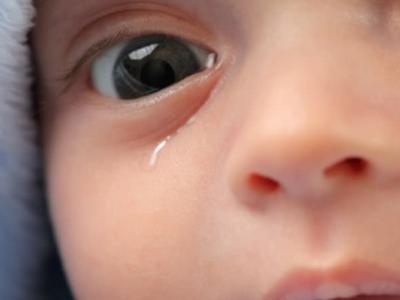 新生儿泪囊炎疼吗 什么是新生儿泪囊炎