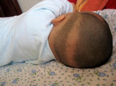 婴儿枕秃什么时候能好 婴儿枕秃怎么办