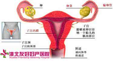 宫颈息肉是怎么形成的 女人宫颈息肉是怎么形成的