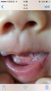 喉咙不断形成痰 宝宝喉咙的痰是怎样形成的呢