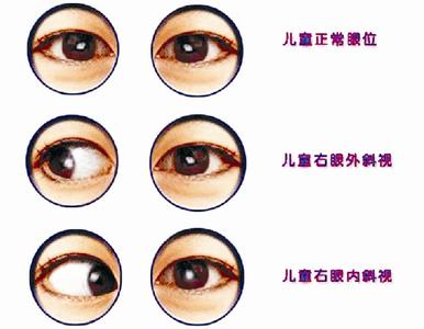 保护眼睛的好方法 小孩子如何保护眼睛 小孩子眼睛保护方法
