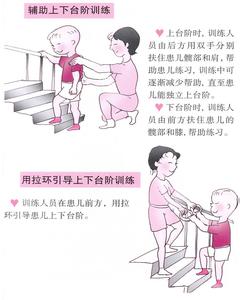 中国脑瘫防治协会 脑瘫是怎样形成的 脑瘫的防治方法