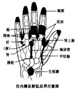 白内障的早期症状 早期白内障的按摩保健