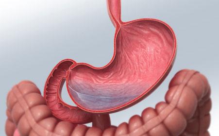 肠胃炎吃什么药好得快 糜烂性胃炎吃什么好得快 肠胃糜烂患者的饮食禁忌