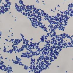 葡萄球菌食物中毒 葡萄球菌中毒怎么办 葡萄球菌中毒治疗方法