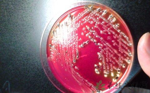 沙门氏菌的危害 沙门氏菌的危害 沙门氏菌有哪些危害
