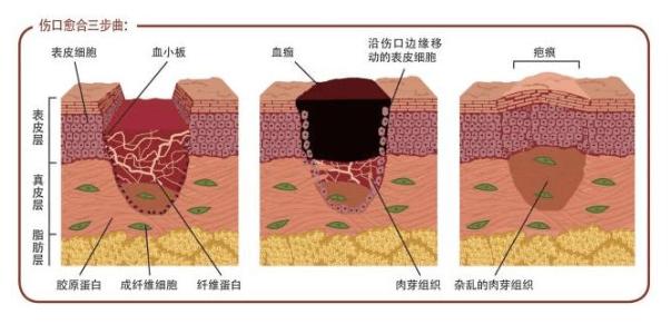 促进伤口愈合的水果 吃什么能促进伤口愈合