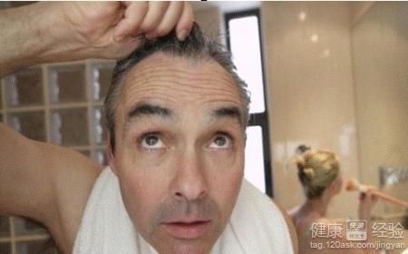 男人脱发的治疗方法 男人脱发怎么治疗 男人脱发治疗方法