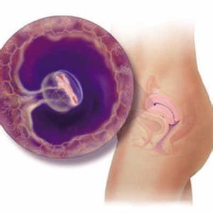 孕期阴道出血 孕期阴道出血的可能原因