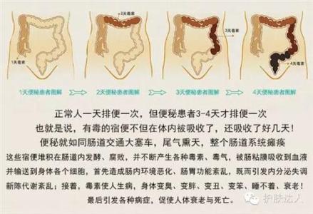 如何清除体内宿便 如何清除宿便？