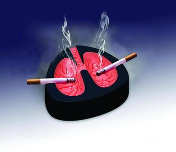 肺癌咳嗽怎么止咳 警惕各种非寻常的咳嗽或是肺癌
