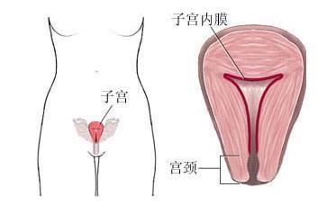 子宫息肉形成的原因 子宫息肉是怎么形成的