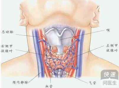 甲状腺结节如何形成的 甲状腺结节是怎么形成的 如何治疗甲状腺结节