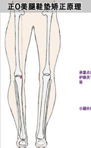 x型腿是怎么形成的 O型X型腿是怎么样形成的