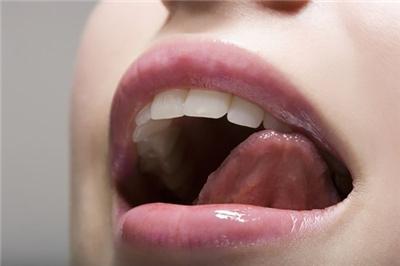 舌头发黑是怎么治疗 舌头发黑怎么办