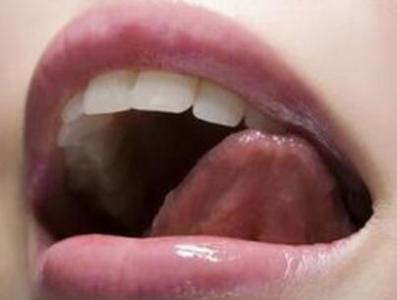 舌尖发麻是什么病兆 舌头发麻是什么原因