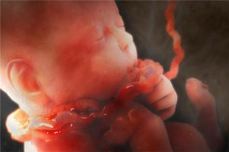 孕期胎儿缺氧的后果 孕妇缺氧的后果
